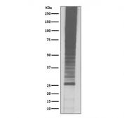 Western blot testing of human Jurkat cell lysate with K48-Linkage Specific Ubiquitin antibody. Multiple ubiquitinated proteins can be detected.