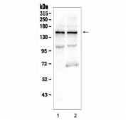 Western blot testing of human 1) K562 and 2) U-2 OS cell lysate with KCNH2 antibody. Expected molecular weight: 127-155 kDa.