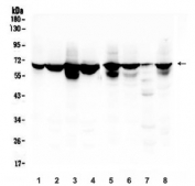 Western blot testing of human 1) placenta, 2) HL-60, 3) K562, 4) ThP-1, 5) HEK293, 6) U-2 OS, 7) U937 and 8) Caco-2 lysate with LBR antibody. Predicted molecular weight ~71 kDa.