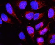 Immunofluorescent staining of human U-2 OS cells with LBR antibody (red) and DAPI nuclear stain (blue). HIER: steam section in pH6 citrate buffer for 20 min.