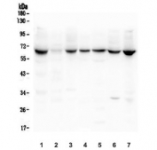 Western blot testing of rat 1) thymus, 2) spleen, 3) testis and mouse 4) thymus, 5) stomach, 6) testis and 7) SP2/0 lysate with LBR antibody. Predicted molecular weight ~71 kDa.