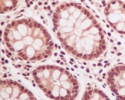 IHC staining of FFPE human colon tissue with Ubiquitin antibody. HIER: boil tissue sections in pH6, 10mM citrate buffer, for 10-20 min and allow to cool before testing.