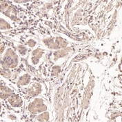 IHC staining of FFPE human stomach tissue with Ubiquitin antibody. HIER: boil tissue sections in pH6, 10mM citrate buffer, for 10-20 min and allow to cool before testing.