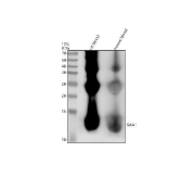 Western blot analysis of SAA1 expression. Whole blood lysates from rat (lane 1) and mouse (lane 2) were analyzed by SDS-PAGE and immunoblotting using an anti-SAA1/Serum Amyloid A antibody. A prominent band is detected at approximately 12 kDa, corresponding to the observed apparent molecular weight of SAA1, which migrates below its predicted molecular weight of approximately 14 kDa. Additional higher molecular weight bands observed at approximately 25 kDa and 38 kDa likely represent oligomeric or lipid-associated forms of SAA commonly detected in blood-derived samples. Proteins were resolved on a 12% SDS-PAGE gel under reducing conditions, transferred to a nitrocellulose membrane, and visualized using HRP-based chemiluminescent detection.