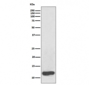 Western blot testing of human plasma lysate with Serum Amyloid A antibody. Predicted molecular weight ~13 kDa.