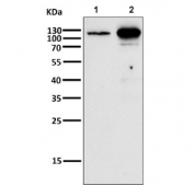 Western blot testing of human 1) A375 and 2) MCF7 cell lysate with Androgen Receptor antibody. Predicted molecular weight ~99 kDa.