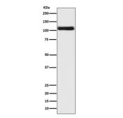 Western blot testing of human LNCaP cell lysate with Androgen Receptor antibody. Predicted molecular weight ~99 kDa.