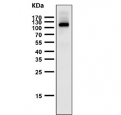 Western blot testing of mouse skin tissue lysate with Androgen Receptor antibody. Predicted molecular weight ~99 kDa.