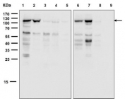 Western blot testing of 1) mouse testis, 2) mouse penis, 3) mouse uterus, 4) mouse ovary, 5) mouse bladder, 6) rat testis, 7) rat penis, 8) rat uterus and 9) rat ovary tissue lysate with Androgen Receptor antibody. Predicted molecular weight ~99 kDa.