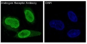 Immunofluorescent staining of FFPE human MCF7 cells with Androgen Receptor antibody (green) and DAPI nuclear stain (blue). HIER: steam section in pH6 citrate buffer for 20 min.