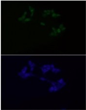 Immunofluorescent staining of FFPE human LNCaP cells with Androgen Receptor antibody (1:500, green) and DAPI nuclear stain (blue). HIER: steam section in pH6 citrate buffer for 20 min.