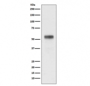 Western blot testing of human MCF-7 cell lysate with RARA antibody. Predicted molecular weight ~51 kDa.