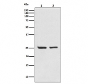 Western blot testing of human 1) Jurkat and 2) MCF-7 cell lysate with Bcl-2 antibody. Predicted molecular weight ~26 kDa.