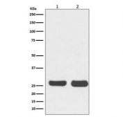 Western blot testing of 1) human HeLa and 2) mouse NIH3T3 cell lysate with BCL2 antibody. Predicted molecular weight ~26 kDa.