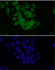 Immunofluorescent staining of FFPE human HeLa cells with Osteopontin antibody (1:50 dilution, green) and DAPI nuclear stain (blue). HIER: steam section in pH6 citrate buffer for 20 min.