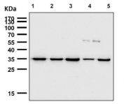 Western blot testing of human 1) HepG2, 2) SW-480, 3) SK-O-V3, 4) MCF7 and 5) HeLa cell lysate with Osteopontin antibody. Predicted molecular weight: 35-65 kDa depending on degree of glycosylation.