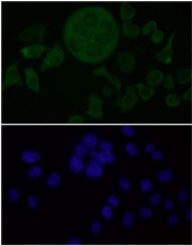 Immunofluorescent staining of FFPE human HeLa cells with Osteopontin antibody (1:150 dilution, green) and DAPI nuclear stain (blue). HIER: steam section in pH6 citrate buffer for 20 min.