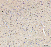Western blot testing of 1) mouse brain and 2) rat brain tissue lysate with Phospho-Tau antibody.