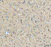 IHC staining of FFPE rat brain tissue with Phospho-Tau antibody, HRP-secondary and DAB substrate. HIER: boil tissue sections in pH8 EDTA for 20 min and allow to cool before testing.