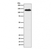 Western blot testing of human fetal lung lysate with c-Kit antibody. Observed molecular weight: ~120/145kDa (precusor/mature).