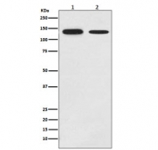 Western blot testing of 1) human MCF-7 and 2) mouse brain lysate with GHR antibody. Predicted molecular weight ~72 kDa but GHR can be glycosylated, ubiquitinated and complex with GH causing a larger than predicted size to be observed.