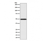 Western blot testing of human Jurkat cell lysate with IRF1 antibody. Expected molecular weight: ~37 kDa (unmodified), 45-50 kDa (modified).