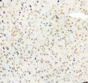 IHC staining of FFPE mouse brain with MID1 antibody. HIER: boil tissue sections in pH6, 10mM citrate buffer, for 20 min and allow to cool before testing.