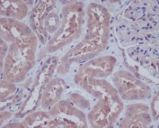 IHC staining of FFPE human spleen tissue with HAPLN1 antibody. HIER: boil tissue sections in pH6, 10mM citrate buffer, for 10-20 min and allow to cool before testing.