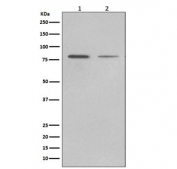 Western blot testing of human 1) LNCaP and 2) HepG2 cell lysate with BiP antibody. Predicted molecular weight: ~73 kDa, but routinely observed at 70-78 kDa.