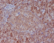 IHC staining of FFPE human pancreas tissue with BiP antibody. HIER: boil tissue sections in pH6, 10mM citrate buffer, for 10-20 min followed by cooling at RT for 20 min.