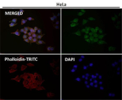 GLUT1 Antibody for IF staining in human HeLa cells. Immunofluorescence analysis using GLUT1 Antibody for IF at 1:50 dilution shows green fluorescent signal corresponding to GLUT1 (SLC2A1) localization along the plasma membrane and within cytoplasmic vesicular structures consistent with glucose transporter distribution in metabolically active cells. Phalloidin-TRITC (red) labels the actin cytoskeleton and outlines cell morphology, while DAPI (blue) marks cell nuclei. The merged image demonstrates membrane-associated GLUT1 fluorescence outlining individual cells and cytoplasmic transporter localization visualized by fluorescence microscopy.
