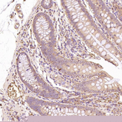 GLUT1 Antibody immunohistochemistry analysis in human colon tissue. FFPE human colon section shows HRP-DAB brown membranous and cytoplasmic staining in epithelial cells lining the colonic glands, consistent with GLUT1 (SLC2A1) localization in metabolically active epithelial cell populations. Stromal cells and surrounding connective tissue show minimal background staining. The section was stained using GLUT1 antibody at 1:200 dilution.