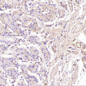 GLUT1 Antibody immunohistochemistry analysis in human stomach tissue. FFPE human stomach section shows HRP-DAB brown membranous and cytoplasmic staining in gastric epithelial cells lining glandular structures, consistent with GLUT1 (SLC2A1) localization in metabolically active epithelial cell populations. Surrounding stromal cells show minimal background staining. The section was stained using GLUT1 antibody at 1:800 dilution.