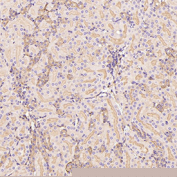 GLUT1 Antibody immunohistochemistry analysis in mouse kidney tissue. FFPE mouse kidney section shows HRP-DAB brown membranous and cytoplasmic staining in renal tubular epithelial cells, consistent with GLUT1 (SLC2A1) localization in metabolically active kidney cell populations. Glomerular structures and surrounding stromal regions show comparatively weaker staining. The section was stained using GLUT1 antibody at 1:300 dilution.