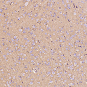 GLUT1 Antibody immunohistochemistry analysis in rat hippocampus tissue. FFPE rat hippocampus section shows HRP-DAB brown cytoplasmic and membranous staining in neuronal and neuropil regions consistent with GLUT1 (SLC2A1) localization in metabolically active brain tissue. The staining highlights cells within hippocampal layers while surrounding background remains minimal. The section was stained using GLUT1 antibody at 1:300 dilution.