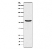 Western blot testing of human HepG2 cell lysate with GLUT2 antibody. Expected molecular weight: 57~70 kDa depending on glycosylation level.
