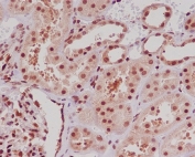 IHC staining of FFPE human kidney tissue with ERG antibody. HIER: boil tissue sections in pH6, 10mM citrate buffer, for 10-20 min followed by cooling at RT for 20 min.