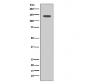 Western blot testing of human SH-SY5Y cell lysate with FGFR1 antibody. Expected molecular weight: 75-160 kDa depending on glycosylation level.