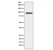 Western blot testing of human Jurkat cell lysate with TOP1 antibody. Expected molecular weight: 91-100 kDa.