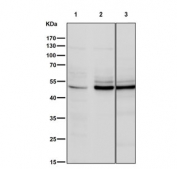 Western blot testing of human 1) HT-1080, 2) TF1-1 and 3) SK-BR-3 cell lysate with Vitamin D Receptor antibody. Predicted molecular weight 48/54 kDa (isoforms 1/2).