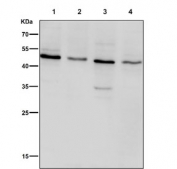 Western blot testing of human 1) HeLa, 2) Jurkat, 3) HepG2 and 4) MCF7 cell lysate with Vitamin D Receptor antibody. Predicted molecular weight 48/54 kDa (isoforms 1/2).