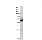 Western blot testing of rat skin tissue lysate with Vitamin D Receptor antibody. Predicted molecular weight 48/54 kDa (isoforms 1/2).