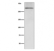 Western blot testing of human fetal heart lysate with Dystrophin antibody. Predicted molecular weight ~427 kDa.