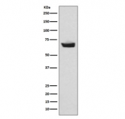 Western blot testing of human plasma lysate with CETP antibody. Expected molecular weight: 66-74 kDa depending on glycosylation level.