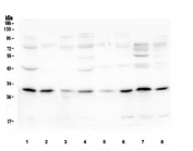 Western blot testing of human 1) 293T, 2) placenta, 3) PC-3, 4) U-87 MG, 5) U-937, 6) HepG2, 7) A431 and 8) U-2 OS cell lysate with PEF1 antibody. Predicted molecular weight ~30 kDa.