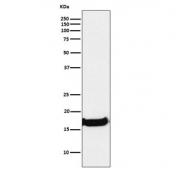 Western blot testing of human A549 cell lysate with Uteroglobin antibody. Expected molecular weight: 10-16 kDa.