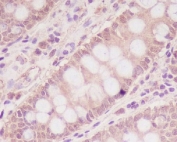 IHC staining of FFPE human colon with M6PR antibody. HIER: boil tissue sections in pH6, 10mM citrate buffer, for 10-20 min and allow to cool before testing.