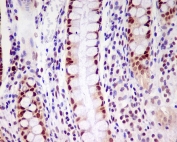 IHC staining of FFPE human colon tissue with PCNA antibody. HIER: boil tissue sections in pH6, 10mM citrate buffer, for 10-20 min and allow to cool before testing.