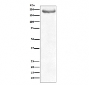 Western blot testing of human brain lysate with NF-H antibody. Predicted molecular weight ~200 kDa.