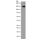 Western blot testing of rat kidney lysate with Collagen VI antibody. Predicted molecular weight ~109 kDa, routinely observed at 140-150 kDa.